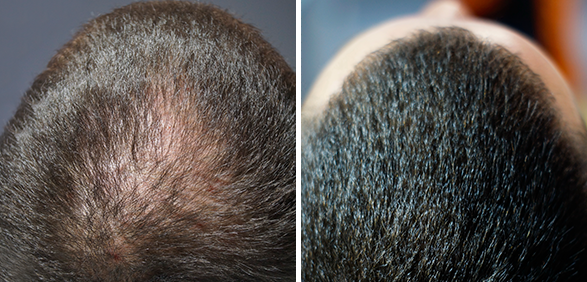 Фото до и после FT Лечение волос и кожи головы