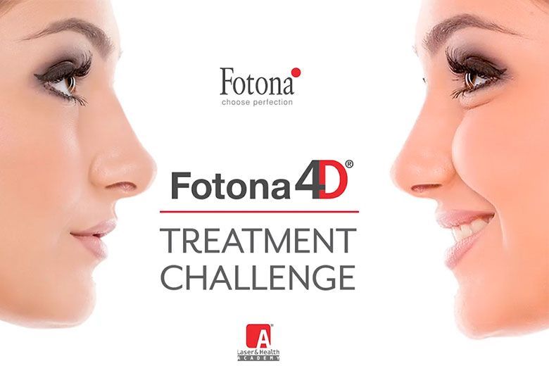 Новости Fotona4D® Treatment Challenge