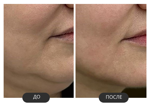 До (10).png
