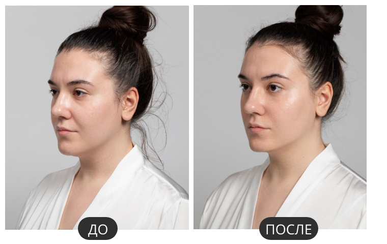 Кейс 1