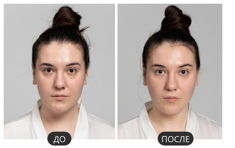 Кейс 1