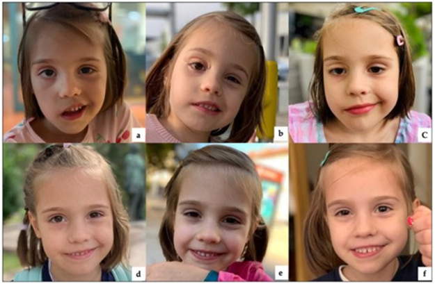 Фото клинического случая 3