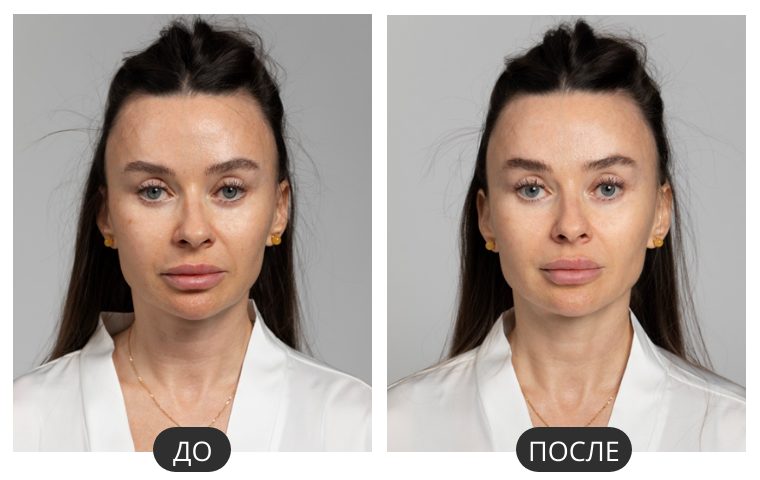 Кейс 2