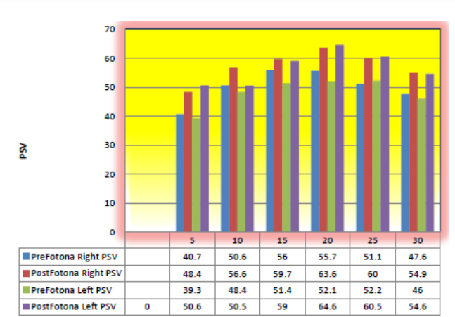 До и после лазерного лечения Средние показатели допплерографии PSV полового члена на 5, 10,15,20,25 и 30 минутах у 17 пациентов