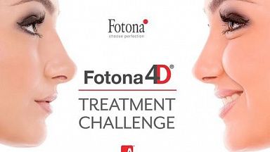 Fotona4D® Treatment Challenge